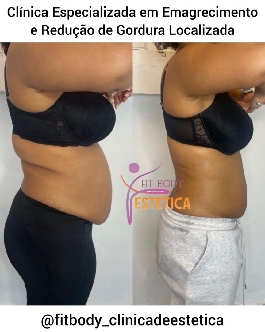 Clínica de Emagrecimento e Gordura Localizada Clínica Fit Body Estética