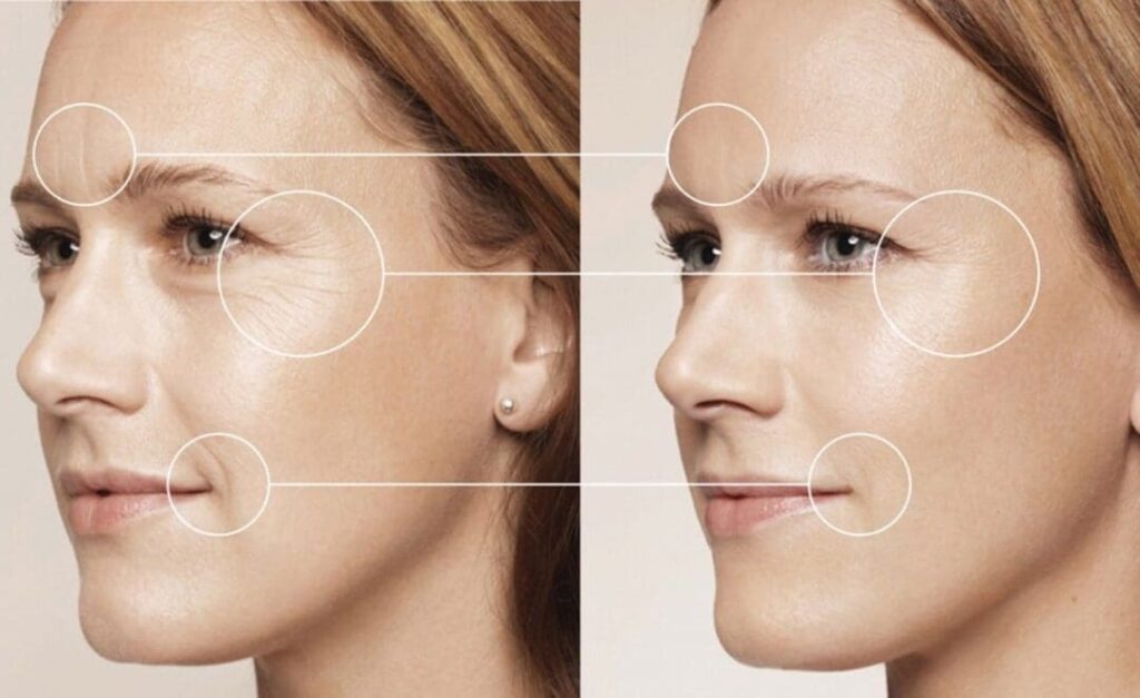 skinbooster