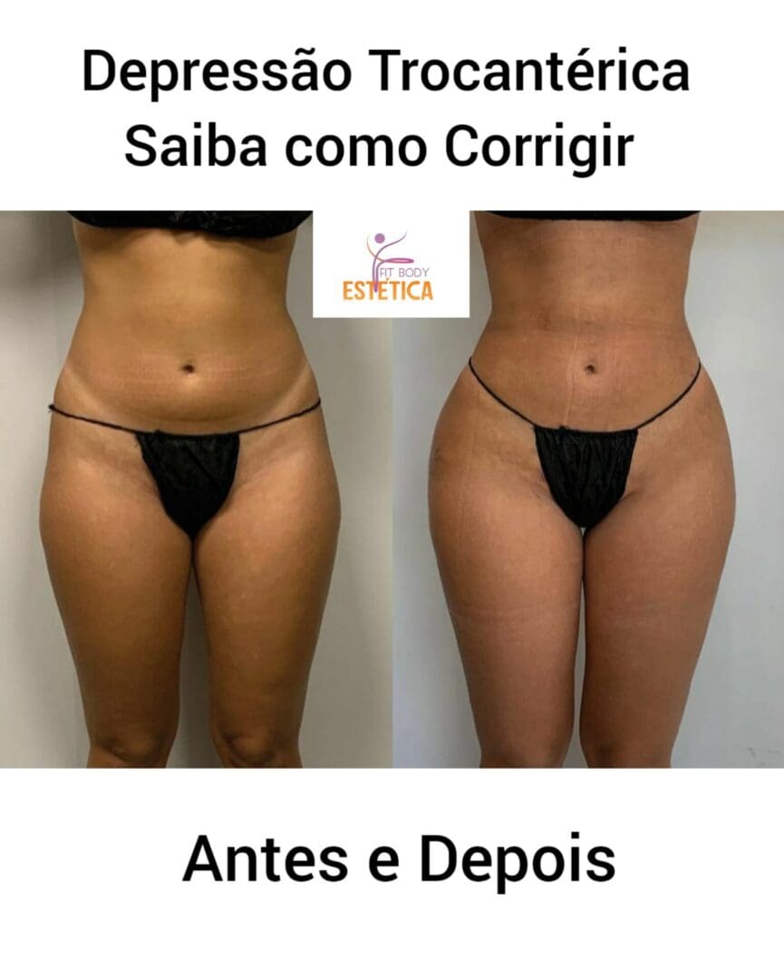 Como Corrigir Hip Dips 