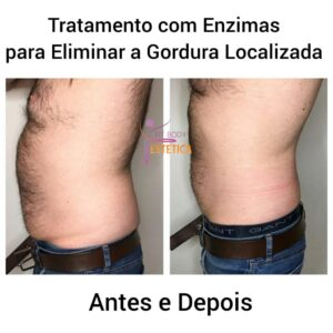 O que fazer para Eliminar a Gordura Localizada: Antes e Depois