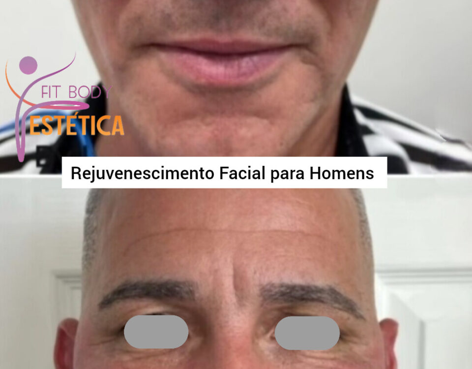 Rejuvenescimento Facial para Homens