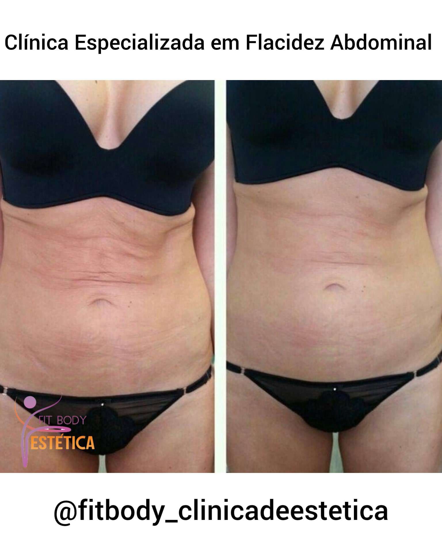 Clínica Especializada em Flacidez Abdominal