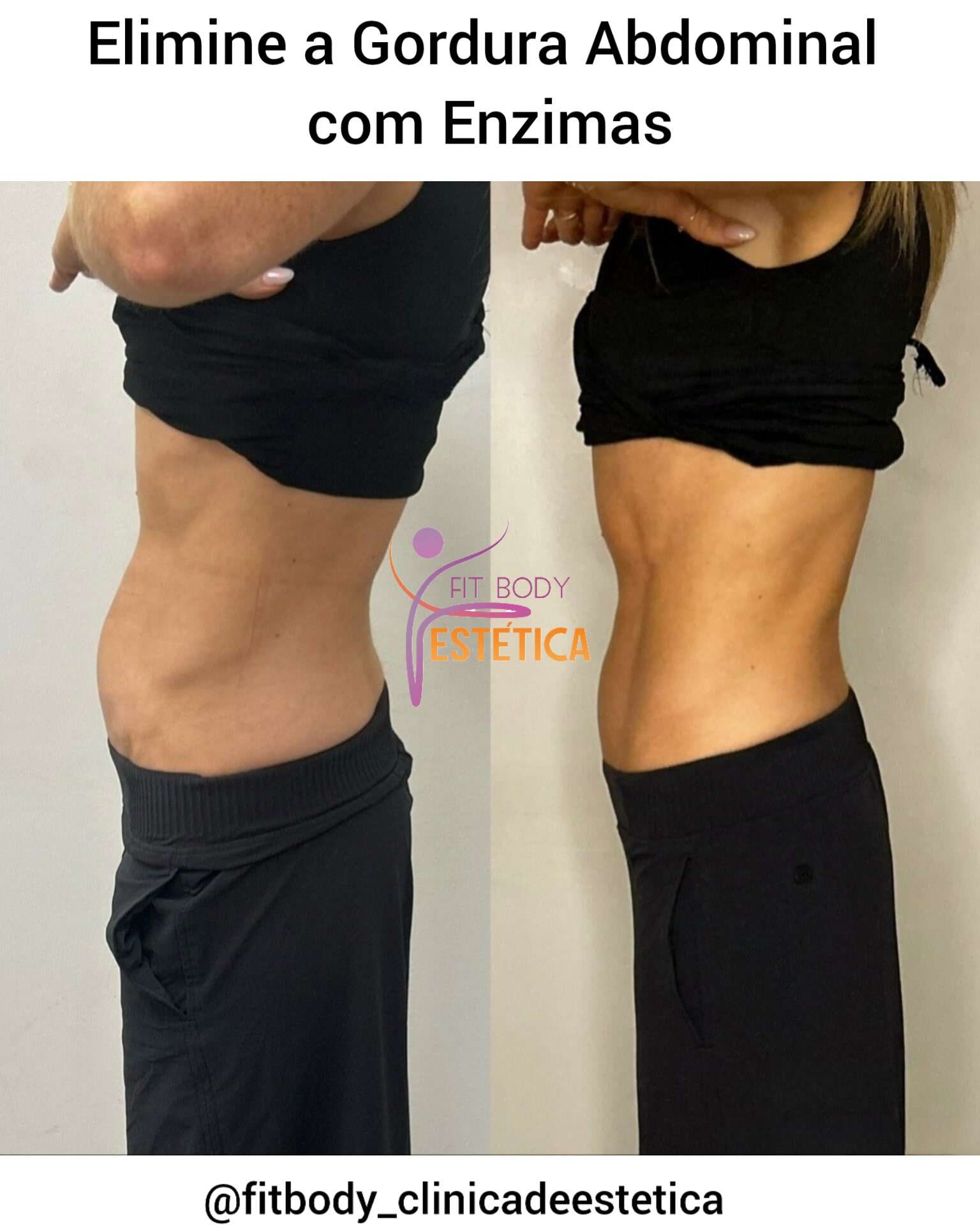 Eliminar Gordura Abdominal com Enzimas