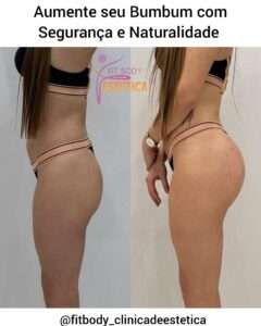 Aumente seu Bumbum com Segurança e Naturalidade