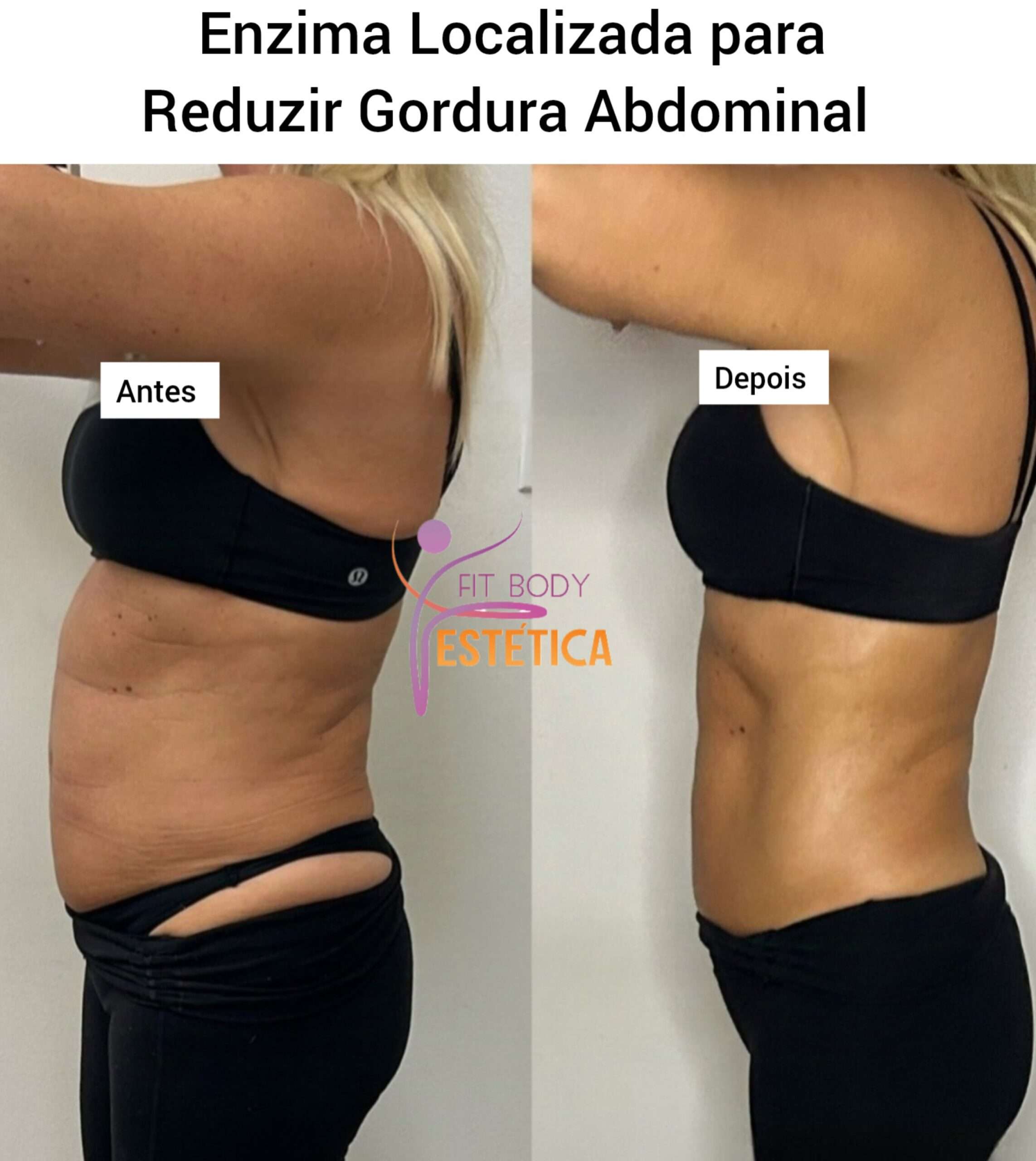 Enzima Localizada para Reduzir Gordura Abdominal