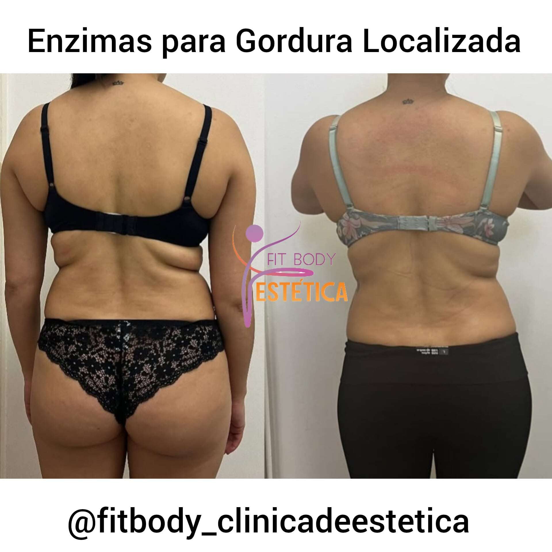 Enzimas para Gordura Localizada Antes e Depois