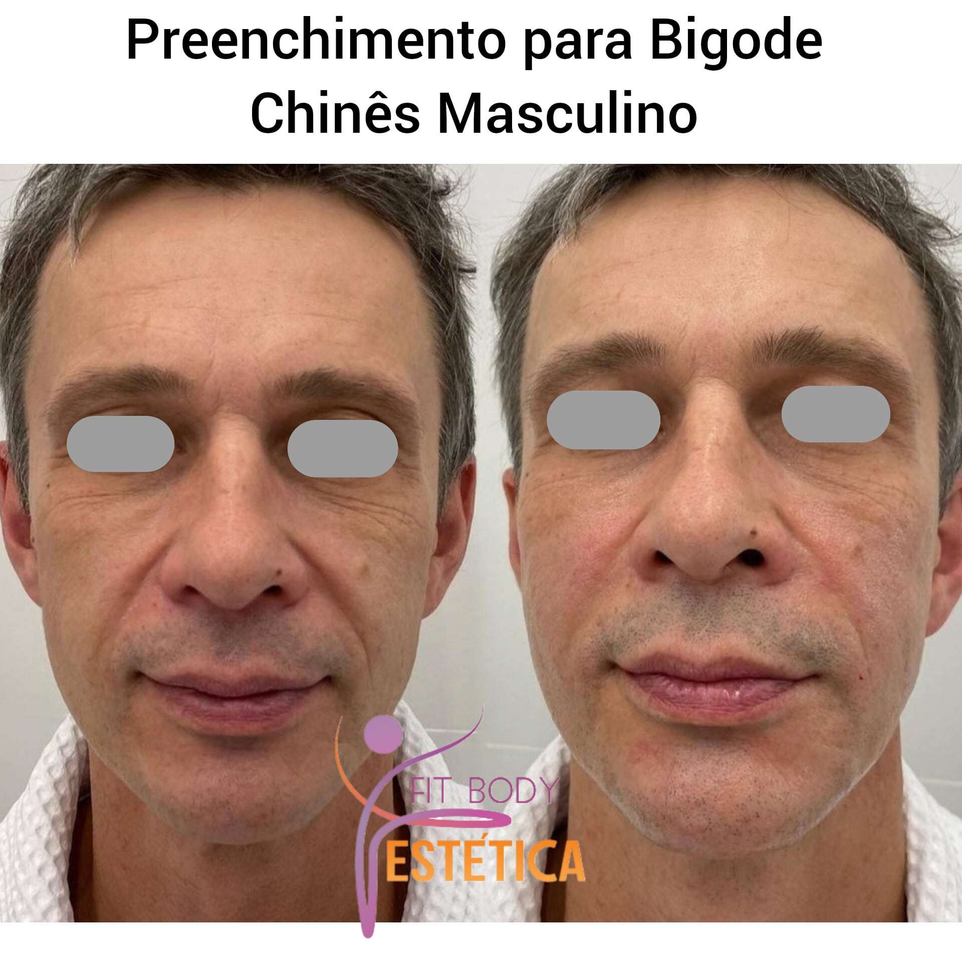 Preenchimento para Bigode Chinês Masculino