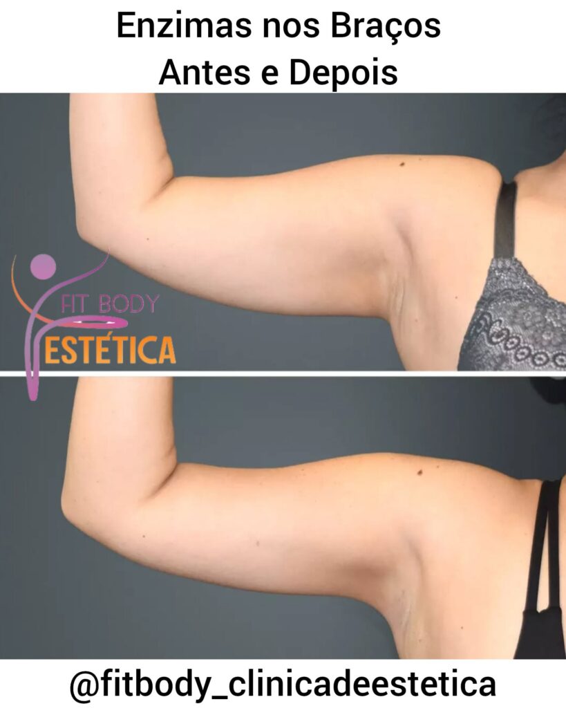 Enzimas nos Braços Antes e Depois
